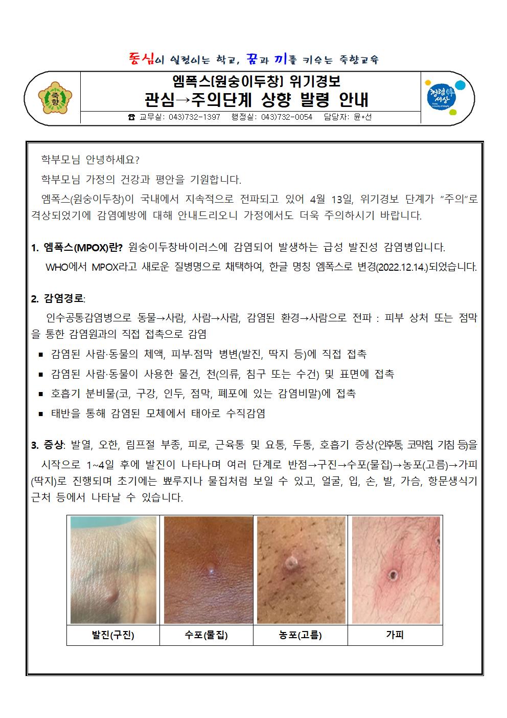 엠폭스 위기경보수준 주의 단계로 상향 조정 안내001